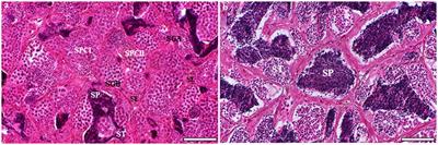 Fine ultrastructural features of germ cells and spermatozoa during spermatogenesis in the European grayling, Thymallus thymallus (Teleostei, Salmoniformes, Salmonidae)